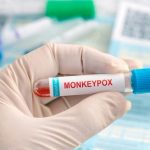 Waspada !!! CACAR MONYET, 1 Orang Dirawat Intensif di Rumah Sakit, 3 Warga Jakarta Barat Suspek Virus Ini