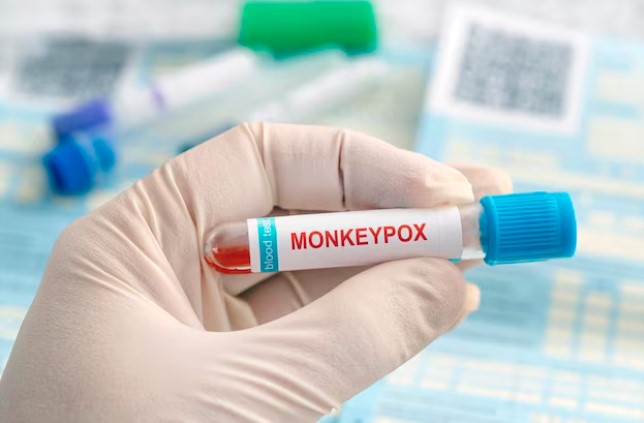 Waspada !!! CACAR MONYET, 1 Orang Dirawat Intensif di Rumah Sakit, 3 Warga Jakarta Barat Suspek Virus Ini